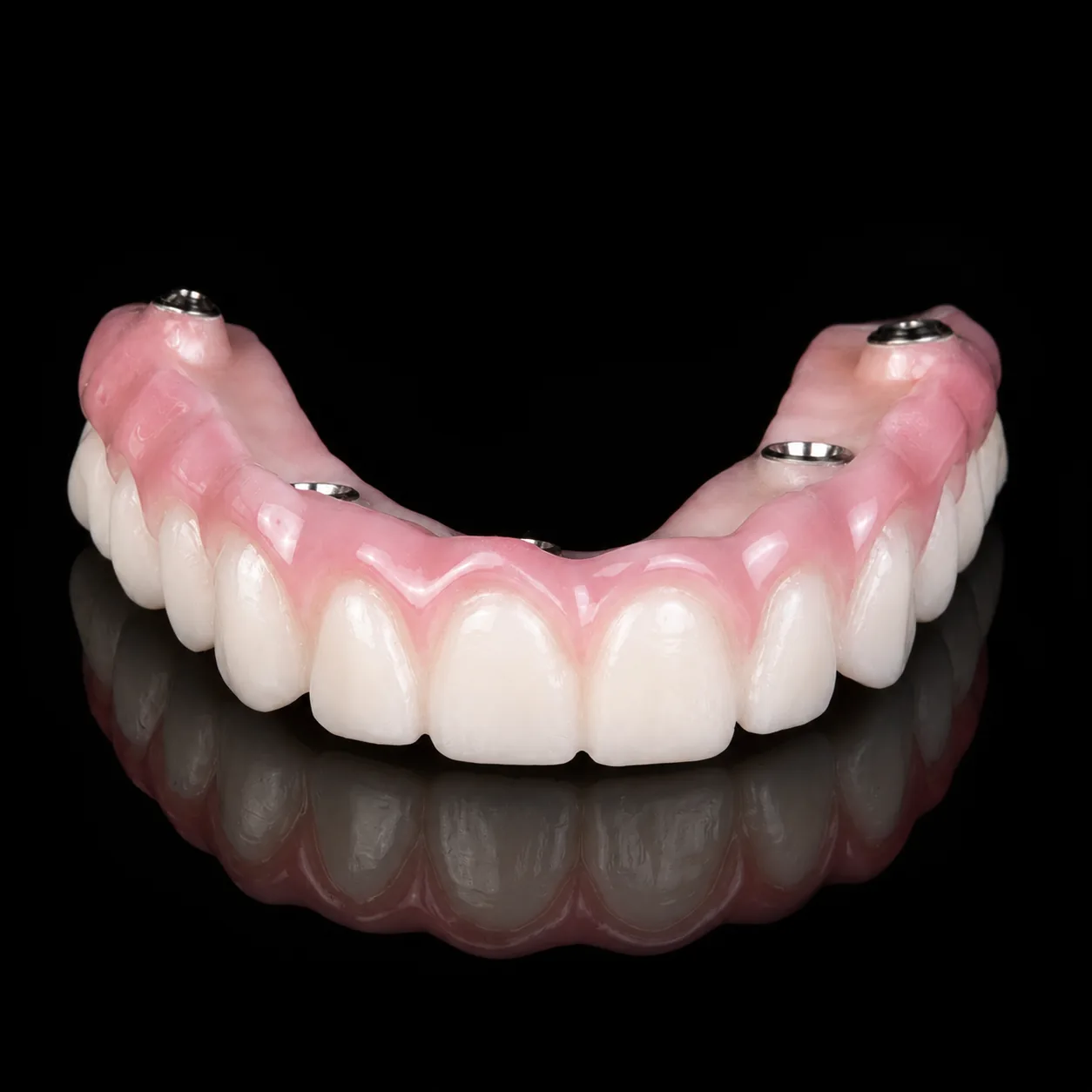 Implantes